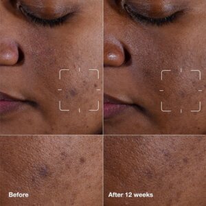 Even Better Clinical Dark 50ml