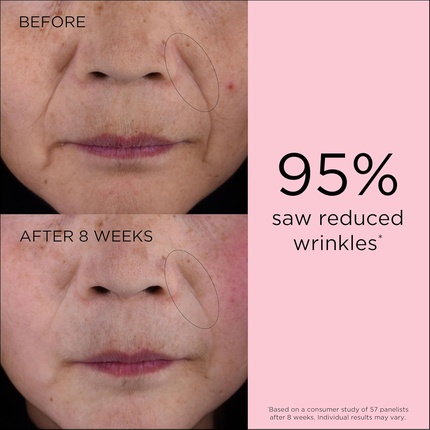 Retinol+ Hpr Ceramide Capsules Rapid Skin Renewing Serum - ceramide capsules Retinol Hpr Ceramide Capsules Seerum