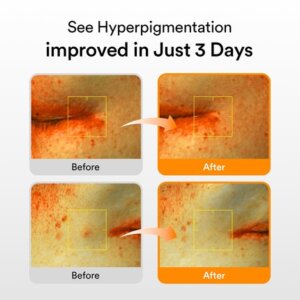 Vita Drop Glutathiosome Dark