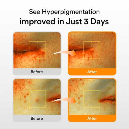 Vita Drop Glutathiosome Dark Spot Serum Vita Drop Glutathiosome Dark