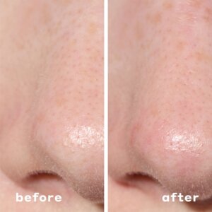 Mario Badescu 2-In-1 Deep Cleansing Pore Strip - Pilt 5